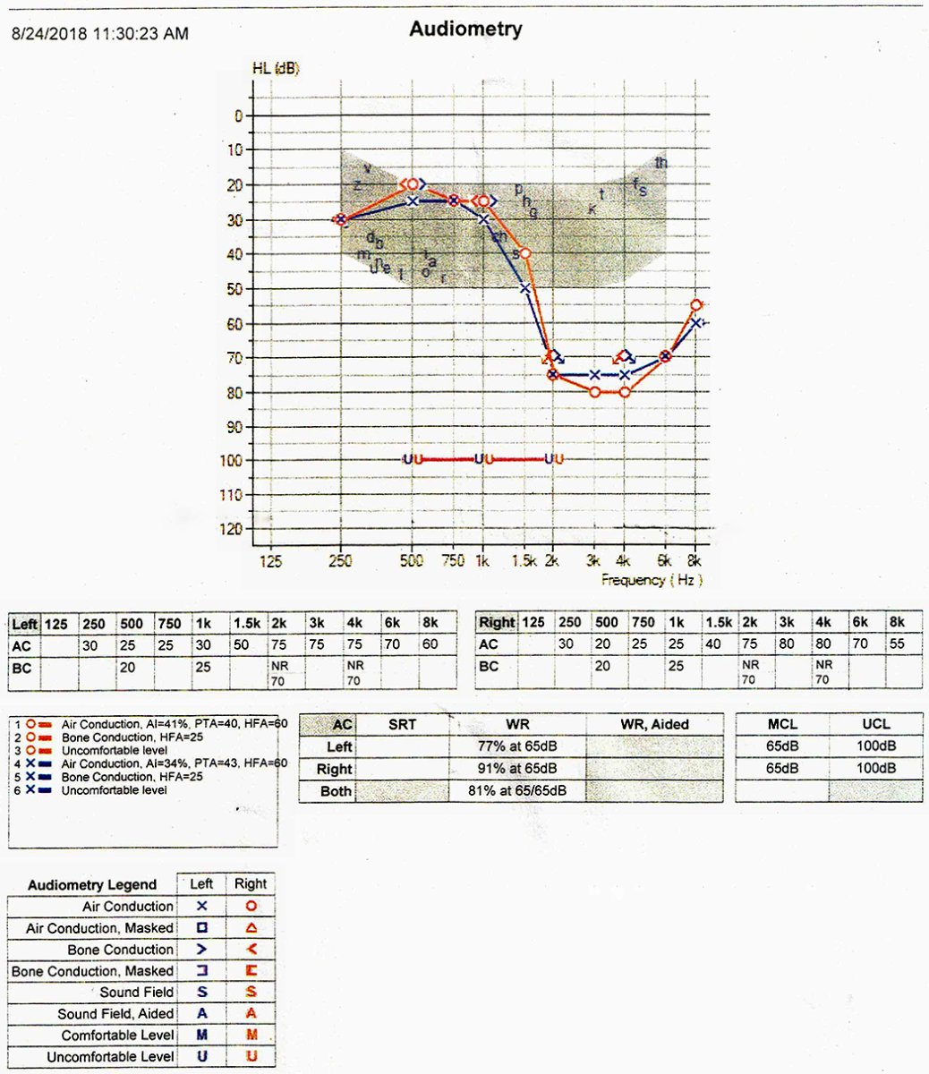 2018 08 24 Hearing Test AZB.jpg