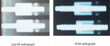 2joint-wxray.jpg