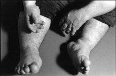 Handsfeet1a.jpg
