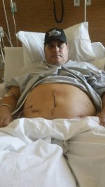 Tommy Hill Surgery (1).jpg