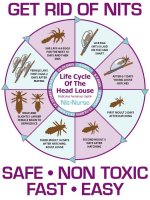c2df0f0470979921d8c2b48776c472d3--lice-life-cycle-nit-treatment.jpg