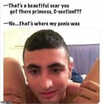 scar.jpg