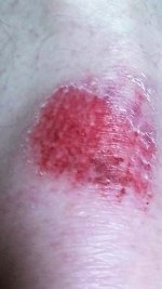 knee good one (3).jpg