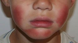 Magic Eraser 1.jpg