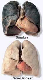 s lungs.jpg